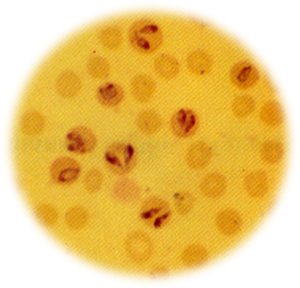 babesia