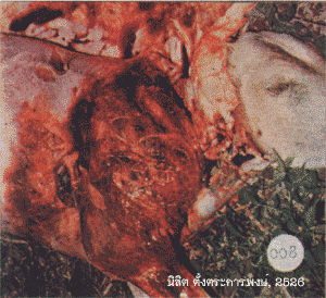 blackleg2