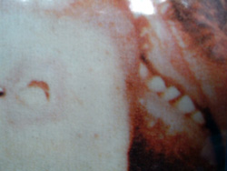 xfmd 1